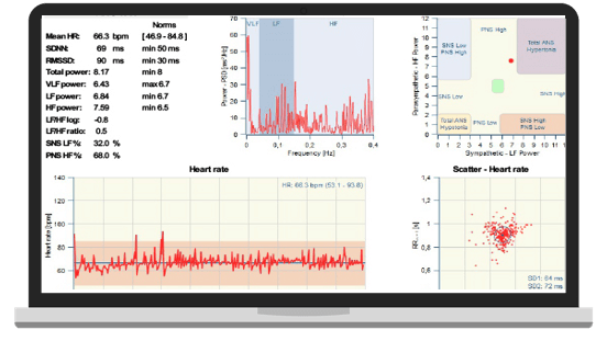 Heart Rate Variability